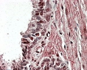 ZNF217 Antibody