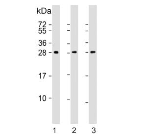 Density Regulated Protein Antibody / DENR