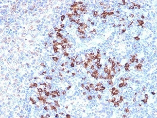 ZFP64 Antibody