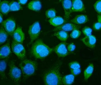 cGAS Antibody / cGAMP Synthase
