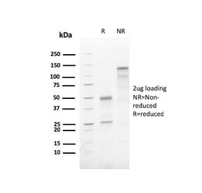 SDS-PAGE analysis of purified, BSA-free recombinant ATG5 antibody (clone AGT5/3220R) as confirmation