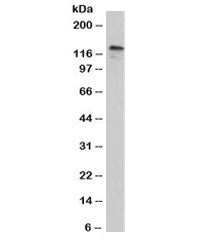 Western blot testing of human A431 cell lysate with P-Cadherin / CDH3 antibody (clone 12H6). Expecte