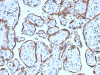 PAPP-A Antibody / Pappalysin-1