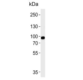 Phospholipase A2 Antibody / PLA2G4A / cPLA2