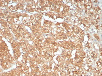IHC staining of FFPE human adrenal gland tissue with ATM antibody (clone ATM/9472). Inset: PBS used