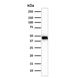 Western blot testing of human skeletal muscle tissue lysate using Muscle Actin antibody (clone rMSA/