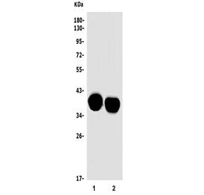 Mt-nd2 Antibody / NADH2