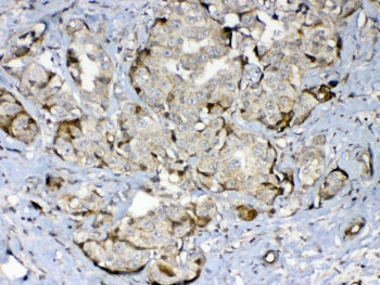 GAD65 Antibody