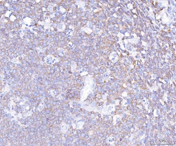 PLCG2 Antibody / Phosphoinositide phospholipase C gamma 2