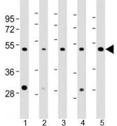 LASS4 Antibody / CerS4