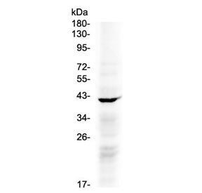 Western blot testing of human COLO320 cell lysate with NDRG3 antibody at 0.5ug/ml. Predicted molecul