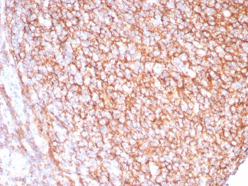 CD21 Antibody