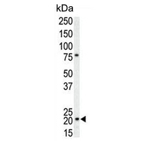 p21 Antibody / CDKN1A