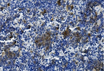 Tigit Antibody / Vstm3 / Vsig9
