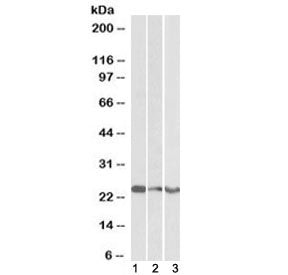 Western blot testing of human 1) cerebellum, 2) frontal cortex and 3) hippocampus lysate with TREM2