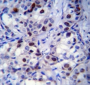 Rb Antibody (Retinoblastoma)