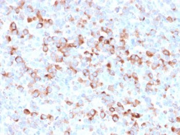 Tyrosinase Antibody