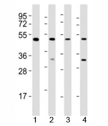 Western blot testing of GATA2 antibody at 1:2000 dilution. Lane 1: K562 lysate; 2: Molt-4 lysate; 3:
