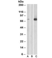 TAK1 Antibody