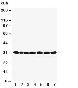 Peroxiredoxin 4 Antibody (PRDX4)