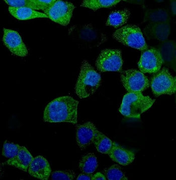 IDO1 Antibody / Indoleamine 2, 3-dioxygenase