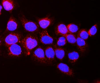 VEGF Receptor 1 / VEGFR1 Antibody