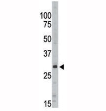 SIRT5 Antibody