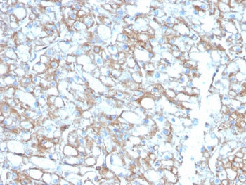 PD-L1 Antibody / B7-H1 / CD274