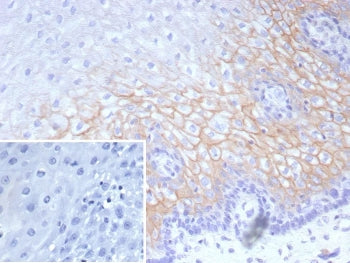 IHC staining of FFPE human esophagus tissue with recombinant Desmocollin-2/3 antibody (clone DSC2/91