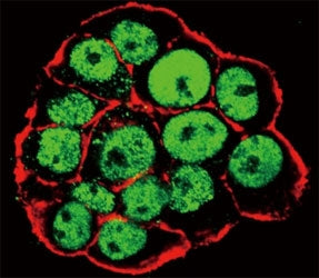 CDX2 Antibody (phospho-S283)