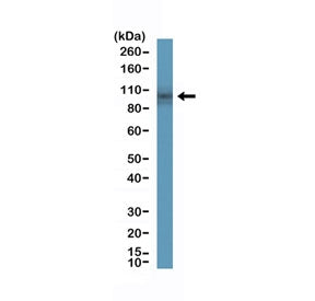 DOG1 Antibody / TMEM16A / ANO1