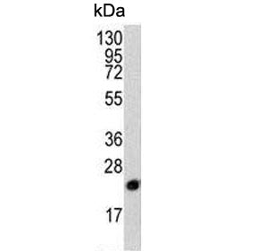 PEBP1 Antibody / PBP / RKIP