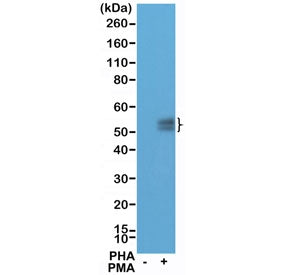 PDCD1 Antibody / PD-1 / PD1 (N-Terminal)