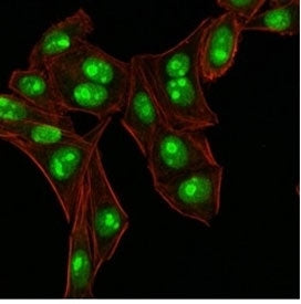 Nucleophosmin Antibody / NPM1