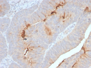 Serum Amyloid A Antibody / SAA1 + SAA2