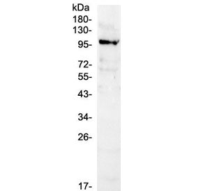 Western blot testing of human K562 cell lysate with NFAT1 antibody at 0.5ug/ml. Predicted molecular