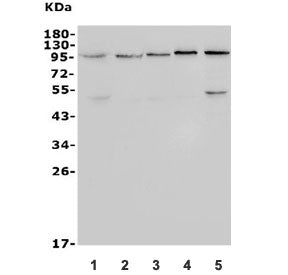 Western blot testing of 1) human HEK293, 2) rat PC-3, 3) rat C6, 4) mouse brain and 5) mouse testis