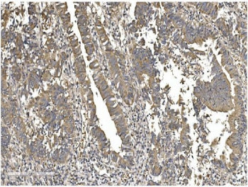 Gasdermin D Antibody / GSDMD
