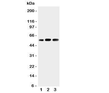 Western blot testing of KIN17 antibody and Lane 1: rat skeletal muscle; 2: human placenta; 3: rat te