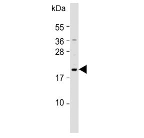 NUDT15 Antibody