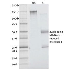 Insulin Receptor alpha Antibody