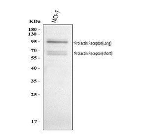 Western blot testing of human MCF7 cell lysate with PRLR antibody. Expected molecular weight: 70-117