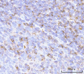 PRTN3 Antibody / Proteinase 3 / Myeloblastin