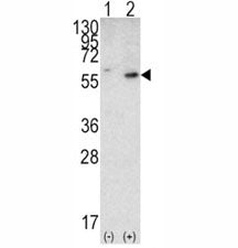 Western blot analysis of PTEN antibody and 293 cell lysate (2 ug/lane) either nontransfected (Lane 1