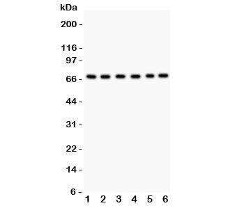 Western blot testing of PKC iota antibody and Lane 1: SHG-44; 2: A549; 3: U87; 4: 293T; 5: HeLa; 6: