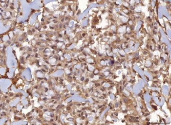 AHA1 Antibody / AHSA1