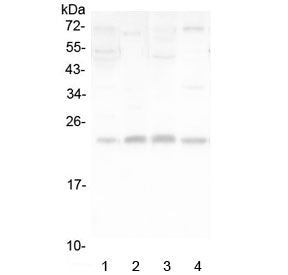 LMO2 Antibody / Rhombotin 2