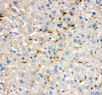 TJP2 Antibody (ZO-2)