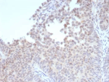 Estrogen Receptor beta 1 Antibody