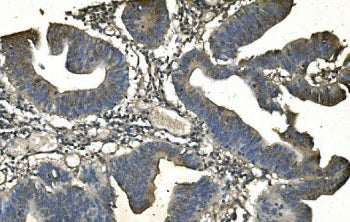 CD13 Antibody / ANPEP